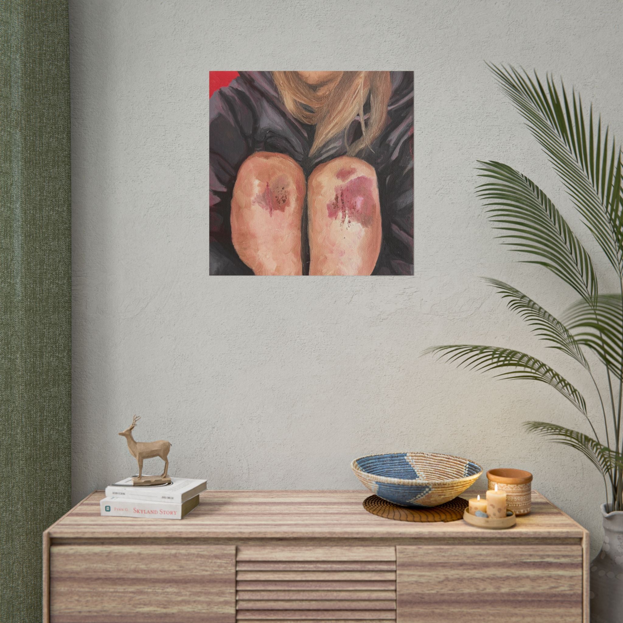 "bruised knees" PRINT