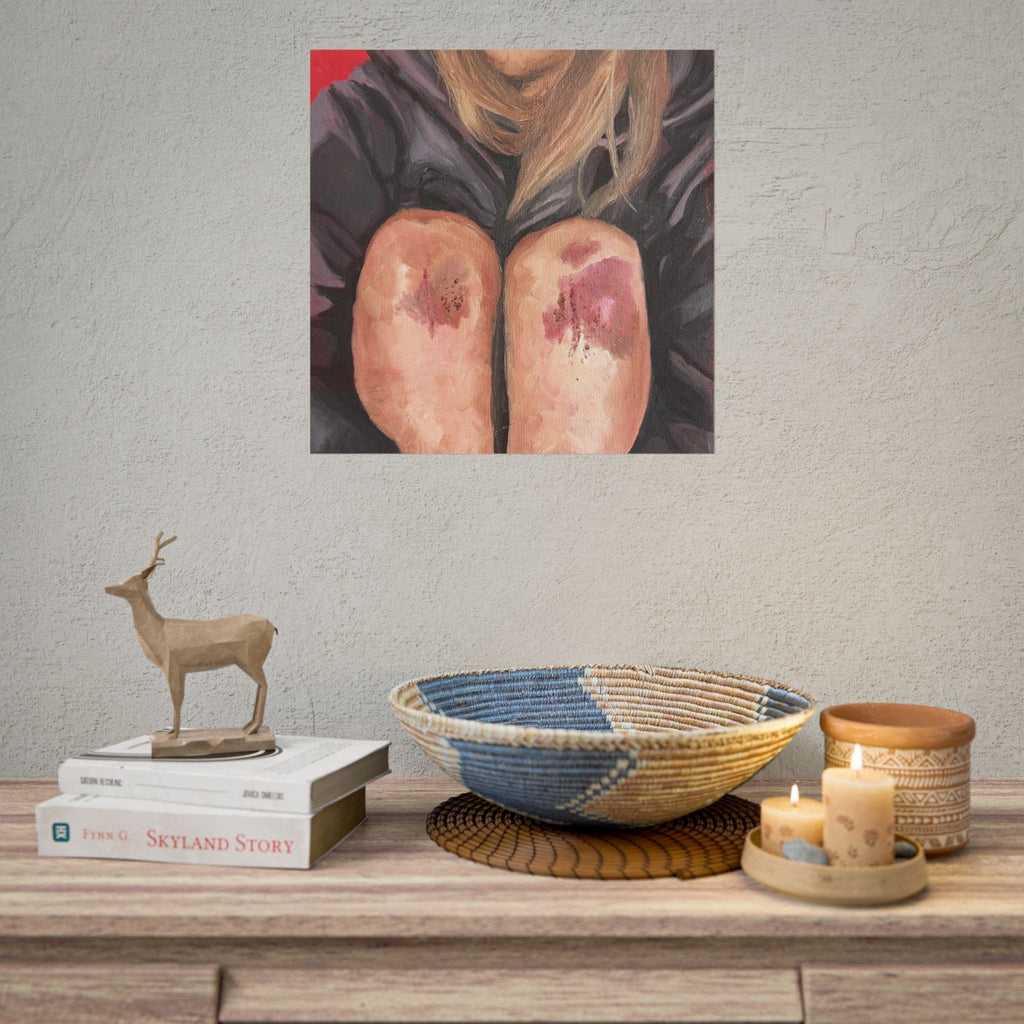 "bruised knees" PRINT